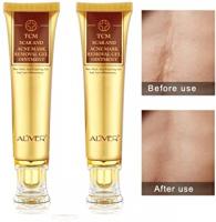 GEL POUR ELIMINER DES CICATRICES DE MTC ET DES MARQUES D ACNE ALIVER 30 GRAMMES X 2 PAQUETS